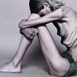 72557_anorexia4lp