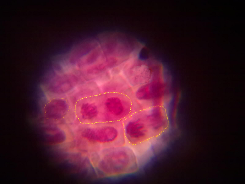 anafase_telofase_1rb_
