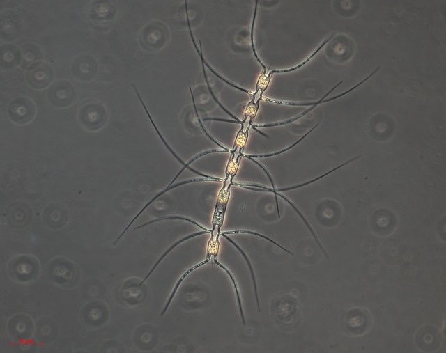 chaetoceros