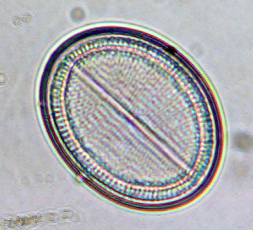 cocconeis