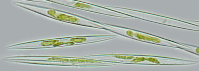 pseudonitzschia