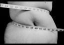 anorexia.jpg