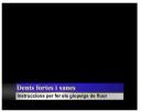 video dents