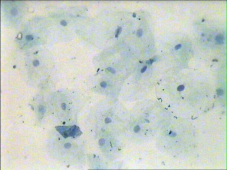 Epiteli bucal on s'bserven les membranes cel.lulars, els nuclis i algunes cadenes de cocs.