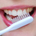 dents