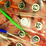 microelectrodos