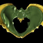 pelvis_comparadas