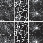 cambios_neuronas