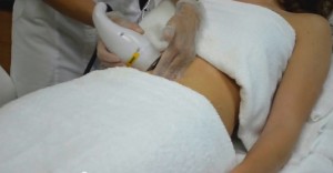 cavitacion
