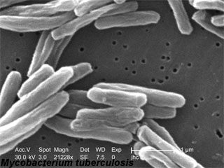 mycobacterium-tuberculosis